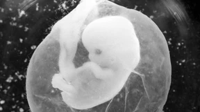 Ein Angriff auf die deutsche Verfassungsidentität