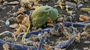 Nicht jeder Dreck muss weg