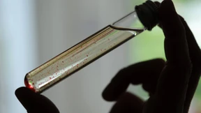 Verdächtige Ampullen bei documenta lösen Polizeieinsatz aus