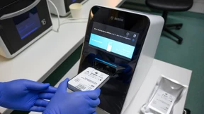 Ein Coronavirus-Test in unter 45 Minuten