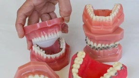 Was bringt eine Zahnspange – außer geraden Zähnen?