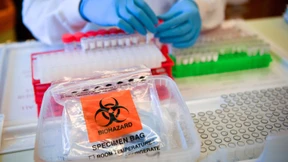 Was hilft gegen Corona?