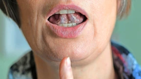 Tiefe Hirnstimulation hilft gegen Stottern