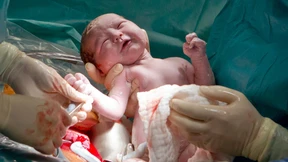 Ein guter Kaiserschnitt macht kein Kind krank