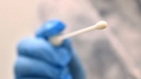 Schluss mit den Gratistests!