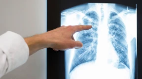 „Die Grenzwerte sind sogar noch zu hoch“