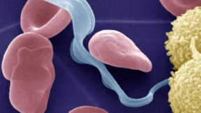 Schlafkrankheit im Blitzgewitter