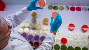 Zahl der EHEC-Infektionen stark gestiegen