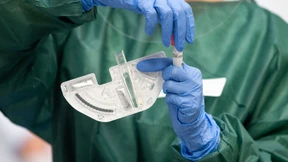 Die Zahl der Corona-Todesopfer steigt