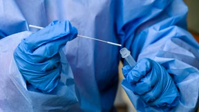 Corona am Geruch erkennen