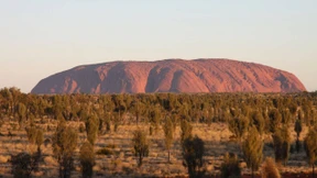 Runter mit der Armbanduhr!