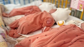 Eineiige Drillinge auf die Welt gebracht