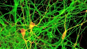 Nerven und Blut im Corona-Trauma