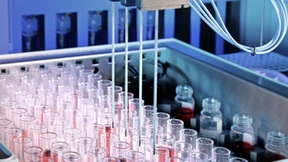 Der Höhenflug von Stratec scheint beendet