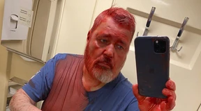 Angriff auf Friedensnobelpreisträger Muratow