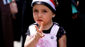 Im Jemen droht 400.000 Kindern der Hungertod