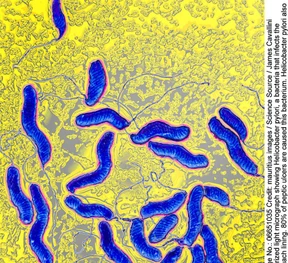Viel mehr als nur lästig