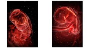 Wer braucht schon Ei, Samen, Uterus?