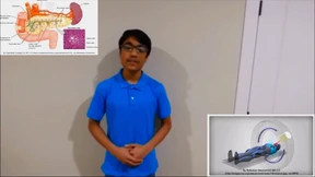 13-jähriger kämpft mit K.I. gegen Krebs