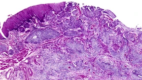 Wenn alles hochkommt