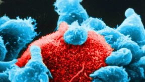 Über Krebs schwebt ein zweiter Schatten