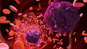 Erste Wirkstoffe gegen erhöhte Lipoproteine in Sicht