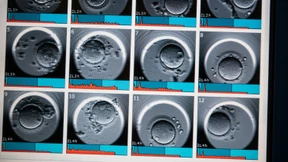 Mutterschutz soll auch bei Fehlgeburt greifen