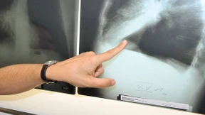 Zu wenig Erfahrung mit Krebs-Operationen