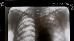 Im Schattenkabinett des Dr. Krokowski