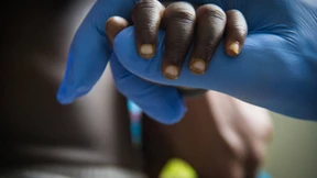 Ein Gesundheitssystem am Limit