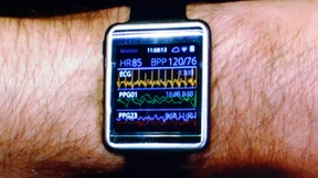 Intensivstation am Arm