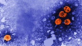 Fälle schwerer Hepatitis bei Kindern