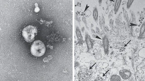 Ist das Coronavirus gefährlicher geworden?