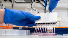 Entwarnung nach Verdachtsfall in Berlin