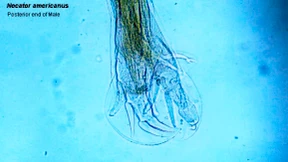 Drei Seiten für den Hakenwurm