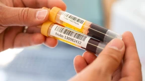 Welchen Schutz bietet uns das eigene Immungedächtnis?