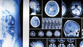 Warum Menschen zu Mördern werden