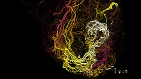 „Ich rechne damit, dass schnell klinische Studien starten“