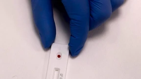 Moment mal: Hatte ich Covid-19 vielleicht schon?