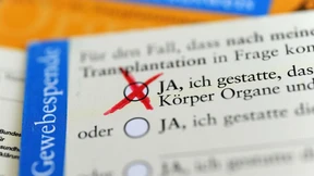 Die Widerspruchsregelung bei der Organspende ist übergriffig