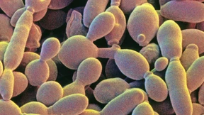 Krebszellen offenbar nicht immer unsterblich