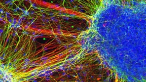 E-Turbo fürs Gehirn