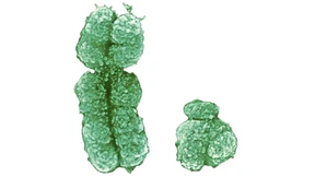 So wird bei Frauen ein X-Chromosom abgeschaltet