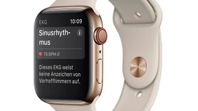 EKG-Funktion der Apple Watch in Europa verfügbar