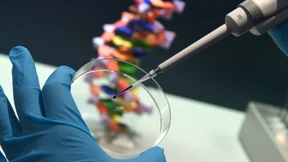 Braune Augen gibt es überall