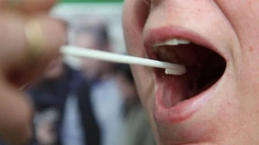 Grenzen bei Massengentests 