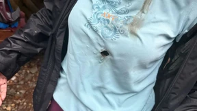 Deutsche Wanderer durch Blitzeinschlag schwer verletzt