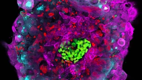 Dürfen Eltern alles über ihre ungeborenen Kinder wissen?