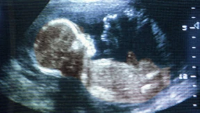 Wir sind total kontrolliert