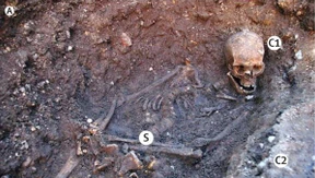 Richard III. war von Spulwürmern befallen